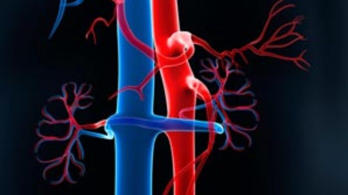 Peripheral vascular disease nclex questions